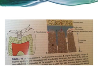 Aula de Revisão MDNM (DP)