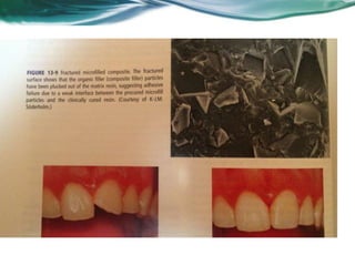 Aula de Revisão MDNM (DP)