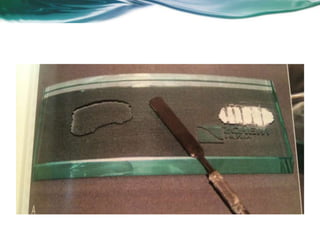 Aula de Revisão MDNM (DP)