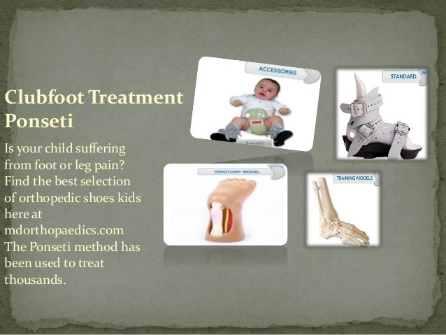 Clubfoot Treatment For Babies