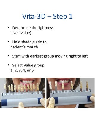 Vita-3D – Step 1
• Determine the lightness
level (value)
• Hold shade guide to
patient’s mouth
• Start with darkest group moving right to left
• Select Value group
1, 2, 3, 4, or 5
 