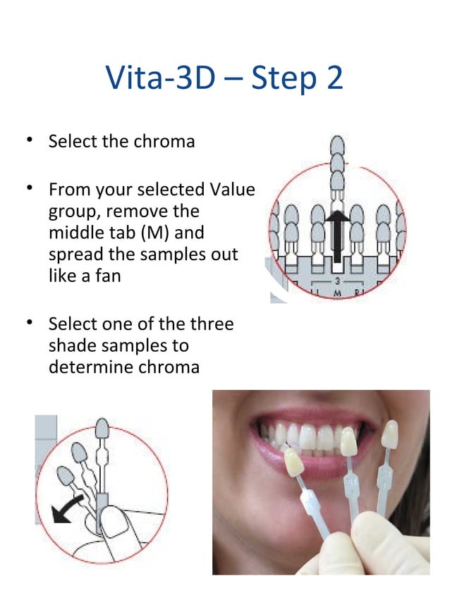 Shade selection for FPD | PPT