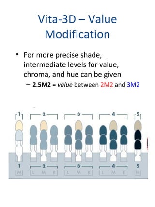 Vita-3D – Value
Modification
• For more precise shade,
intermediate levels for value,
chroma, and hue can be given
– 2.5M2 = value between 2M2 and 3M2
 