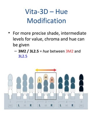 Vita-3D – Hue
Modification
• For more precise shade, intermediate
levels for value, chroma and hue can
be given
– 3M2 / 3L2.5 = hue between 3M2 and
3L2.5
 