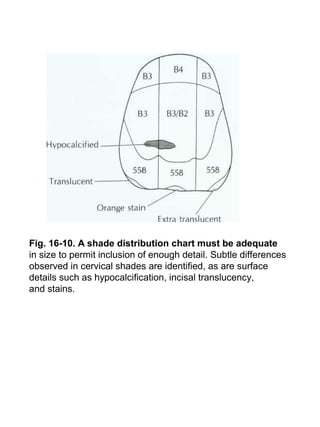 Fig. 16-10. A shade distribution chart must be adequate
in size to permit inclusion of enough detail. Subtle differences
observed in cervical shades are identified, as are surface
details such as hypocalcification, incisal translucency,
and stains.
 