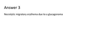 Answer 3
Necrolytic migratory erythema due to a glucagonoma
 