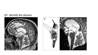 Q7. Identify the disease
 