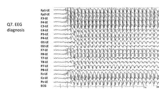 Q7. EEG
diagnosis
 