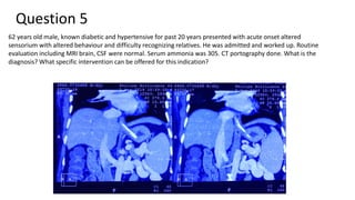 Question 5
62 years old male, known diabetic and hypertensive for past 20 years presented with acute onset altered
sensorium with altered behaviour and difficulty recognizing relatives. He was admitted and worked up. Routine
evaluation including MRI brain, CSF were normal. Serum ammonia was 305. CT portography done. What is the
diagnosis? What specific intervention can be offered for this indication?
 