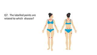 Q7. The labelled points are
related to which disease?
 