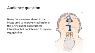 Name the maneuver shown in the
image used to improve visualization of
the larynx during endotracheal
intubation, but not intended to prevent
regurgitation.
Audience question
 