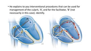 • He explains to you interventional procedures that can be used for
management of the culprit, ‘A’, and for the facilitator, ‘B’ (not
necessarily in this case). Identify.
 