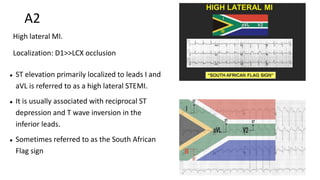 A2
High lateral MI.
Localization: D1>>LCX occlusion
● ST elevation primarily localized to leads I and
aVL is referred to as a high lateral STEMI.
● It is usually associated with reciprocal ST
depression and T wave inversion in the
inferior leads.
● Sometimes referred to as the South African
Flag sign
 