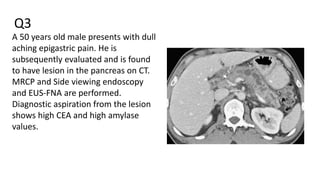 Q3
A 50 years old male presents with dull
aching epigastric pain. He is
subsequently evaluated and is found
to have lesion in the pancreas on CT.
MRCP and Side viewing endoscopy
and EUS-FNA are performed.
Diagnostic aspiration from the lesion
shows high CEA and high amylase
values.
 