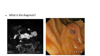 ● What is the diagnosis?
 