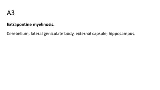 A3
Extrapontine myelinosis.
Cerebellum, lateral geniculate body, external capsule, hippocampus.
 