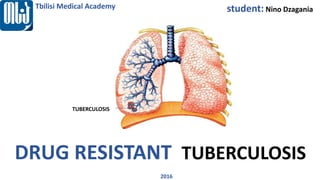 DRUG RESISTANT TUBERCULOSIS
tuberculosis
Tbilisi Medical Academy
2016
student: Nino Dzagania
TUBERCULOSIS
 