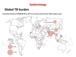 Epidemiology
Global TB burden
 