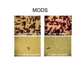 MODS
 