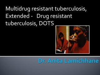 Multidrug resistant tuberculosis,
Extended - Drug resistant
tuberculosis, DOTS
 