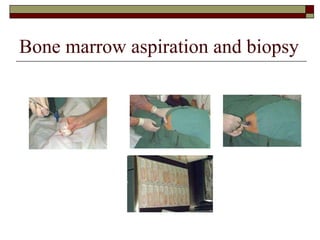 Bone marrow aspiration and biopsy 