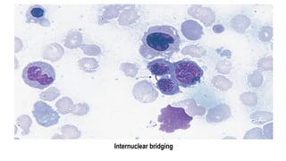Internuclear bridging
 