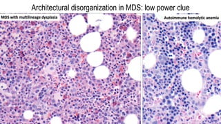 Architectural disorganization in MDS: low power clue
 