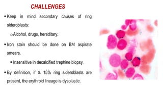 CHALLENGES
§ Keep in mind secondary causes of ring
sideroblasts:
oAlcohol, drugs, hereditary.
§ Iron stain should be done on BM aspirate
smears.
§ Insensitive in decalcified trephine biopsy.
§ By definition, if ≥ 15% ring sideroblasts are
present, the erythroid lineage is dysplastic.
 