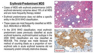 Erythroid-Predominant MDS
• Cases of MDS with erythroid predominance (≥50%
erythroid elements) comprise about 15% of all MDS
and are more frequently therapy related
• Erythroid predominance does not define a specific
entity in the 2016 WHO classification.
• These cases are most frequently classified as MDS-
SLD, MDS-MLD or MDS-RS.
• In the 2016 WHO classification, most erythroid-
predominant cases previously classified as acute
erythroid leukemia, erythroid/myeloid subtype in the
2008 WHO classification are now classified as
MDS-EB. This change was made because the
method of counting blasts as a proportion of non-
erythroid cells in acute erythroid leukemia did not
necessarily predict clinically distinctive disease. Glycophorin
 