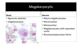 Myelodysplastic Syndrome | PPTX