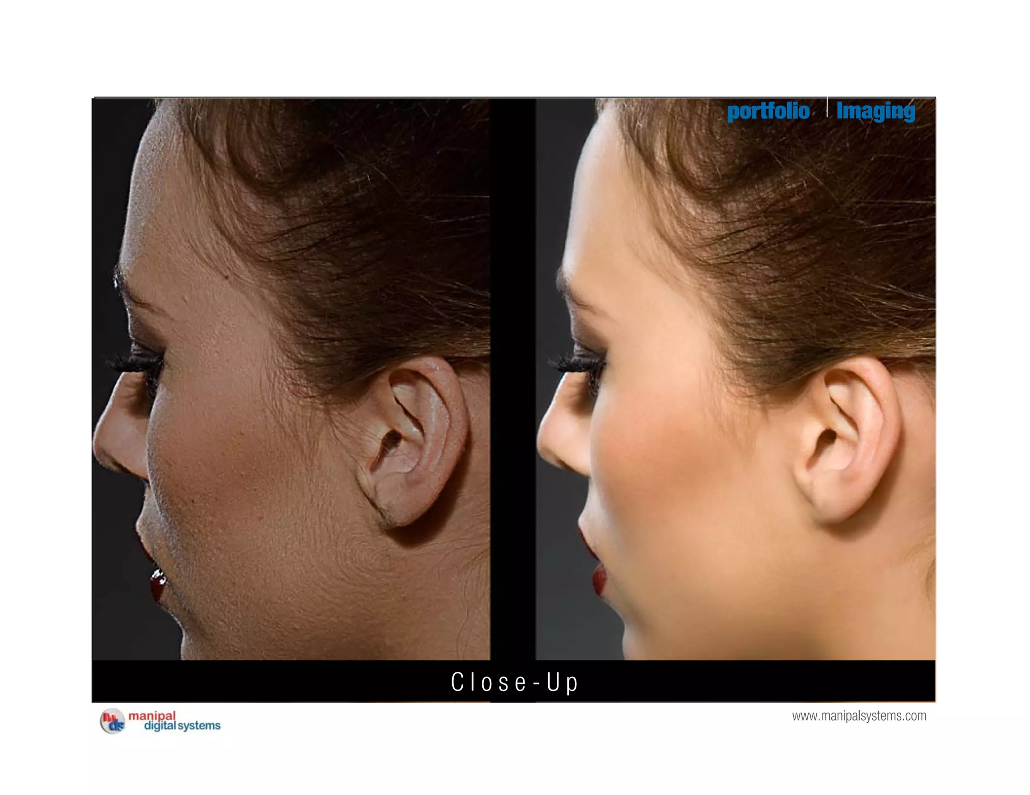 portfolio     Imaging




Close-Up
                  www.manipalsystems.com
 