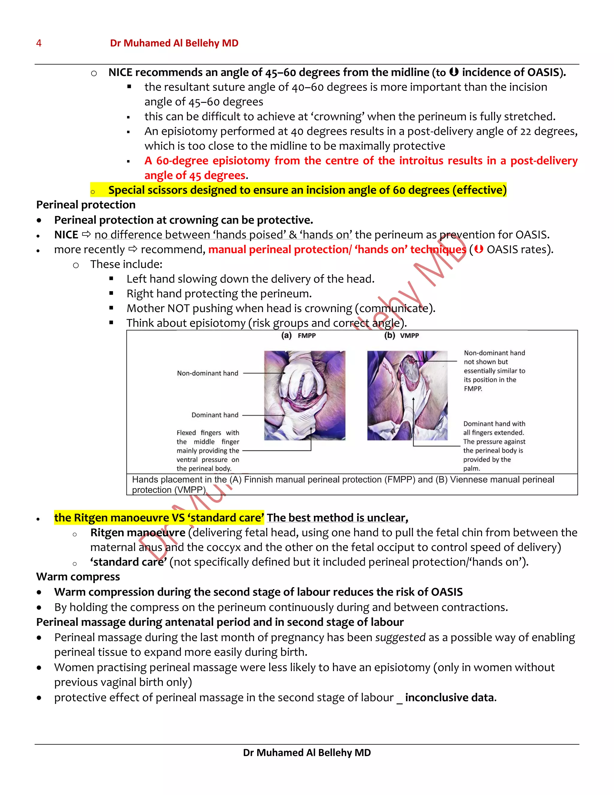 4 Dr Muhamed Al Bellehy MD
Dr Muhamed Al Bellehy MD
o NICE recommends an angle of 45–60 degrees from the midline (to  incidence of OASIS).
 the resultant suture angle of 40–60 degrees is more important than the incision
angle of 45–60 degrees
 this can be difficult to achieve at ‘crowning’ when the perineum is fully stretched.
 An episiotomy performed at 40 degrees results in a post-delivery angle of 22 degrees,
which is too close to the midline to be maximally protective
 A 60-degree episiotomy from the centre of the introitus results in a post-delivery
angle of 45 degrees.
o Special scissors designed to ensure an incision angle of 60 degrees (effective)
Perineal protection
 Perineal protection at crowning can be protective.
 NICE  no difference between ‘hands poised’ & ‘hands on’ the perineum as prevention for OASIS.
 more recently  recommend, manual perineal protection/ ‘hands on’ techniques ( OASIS rates).
o These include:
 Left hand slowing down the delivery of the head.
 Right hand protecting the perineum.
 Mother NOT pushing when head is crowning (communicate).
 Think about episiotomy (risk groups and correct angle).
Hands placement in the (A) Finnish manual perineal protection (FMPP) and (B) Viennese manual perineal
protection (VMPP)
 the Ritgen manoeuvre VS ‘standard care’ The best method is unclear,
o Ritgen manoeuvre (delivering fetal head, using one hand to pull the fetal chin from between the
maternal anus and the coccyx and the other on the fetal occiput to control speed of delivery)
o ‘standard care’ (not specifically defined but it included perineal protection/‘hands on’).
Warm compress
 Warm compression during the second stage of labour reduces the risk of OASIS
 By holding the compress on the perineum continuously during and between contractions.
Perineal massage during antenatal period and in second stage of labour
 Perineal massage during the last month of pregnancy has been suggested as a possible way of enabling
perineal tissue to expand more easily during birth.
 Women practising perineal massage were less likely to have an episiotomy (only in women without
previous vaginal birth only)
 protective effect of perineal massage in the second stage of labour _ inconclusive data.
 
