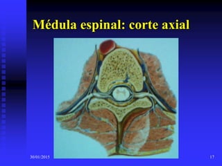 30/01/2015 17
Médula espinal: corte axial
 