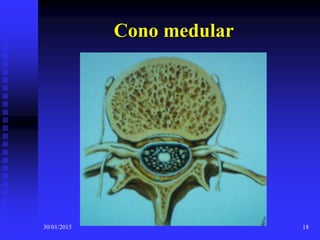 30/01/2015 18
Cono medular
 