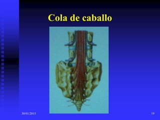 30/01/2015 19
Cola de caballo
 