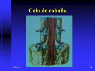 30/01/2015 20
Cola de caballo
 
