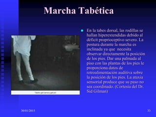 30/01/2015 33
Marcha Tabética
 En la tabes dorsal, las rodillas se
hallan hiperextendidas debido al
déficit proprioceptivo severo. La
postura durante la marcha es
inclinada ya que necesita
observar directamente la posición
de los pies. Dar una palmada al
piso con las plantas de los pies le
proporciona datos de
retroalimentación auditiva sobre
la posición de los pies. La ataxia
sensorial produce que su paso no
sea coordinado. (Cortesía del Dr.
Sid Gilman)
 