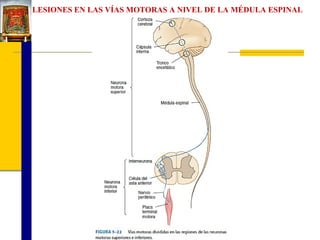 LESIONES EN LAS VÍAS MOTORAS A NIVEL DE LA MÉDULA ESPINAL

 