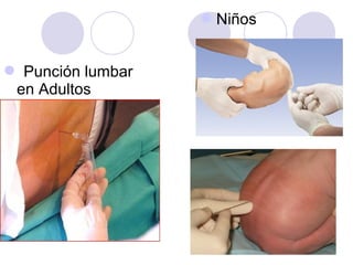  Punción lumbar
en Adultos
Niños
 