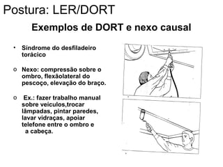 Exemplos de DORT e nexo causal
• Síndrome do desfiladeiro
torácico
o Nexo: compressão sobre o
ombro, flexãolateral do
pescoço, elevação do braço.
o Ex.: fazer trabalho manual
sobre veículos,trocar
lâmpadas, pintar paredes,
lavar vidraças, apoiar
telefone entre o ombro e
a cabeça.
Postura: LER/DORT
 