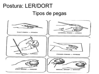 Tipos de pegas
Postura: LER/DORT
 