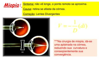 Miopia: Sintoma: não vê longe, o ponto remoto se aproxima.
Causa: retina se afasta da córnea.
Correção: Lentes Divergentes
***Na cirurgia de miopia, dá-se
uma aplainada na córnea,
reduzindo sua curvatura e
conseqüentemente sua
convergência.
1
( )V di
D
= −
 