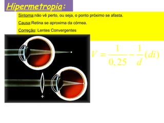 Hipermetropia:
Sintoma:não vê perto, ou seja, o ponto próximo se afasta.
Causa:Retina se aproxima da córnea.
Correção: Lentes Convergentes
1 1
( )
0,25
V di
d
= −
 