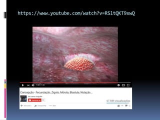 https://www.youtube.com/watch?v=RSltQKT9xwQ