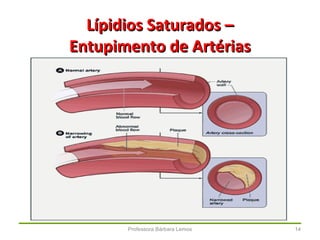 Professora Bárbara Lemos 14
Lípidios Saturados –Lípidios Saturados –
Entupimento de ArtériasEntupimento de Artérias
 