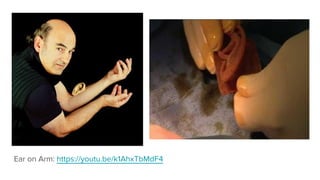 Ear on Arm: https://youtu.be/k1AhxTbMdF4
 