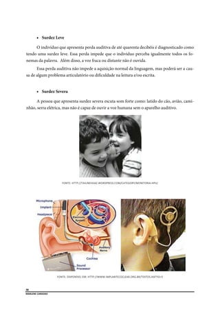  
38
MARLENE CARDOSO 
 
 Surdez Leve
O indivíduo que apresenta perda auditiva de até quarenta decibéis é diagnosticado como
tendo uma surdez leve. Essa perda impede que o indivíduo perceba igualmente todos os fo-
nemas da palavra. Além disso, a voz fraca ou distante não é ouvida.
Essa perda auditiva não impede a aquisição normal da linguagem, mas poderá ser a cau-
sa de algum problema articulatório ou dificuldade na leitura e/ou escrita.
 Surdez Severa
A pessoa que apresenta surdez severa escuta som forte como: latido do cão, avião, cami-
nhão, serra elétrica, mas não é capaz de ouvir a voz humana sem o aparelho auditivo.
FONTE: HTTP://TAILINEHIJAZ.WORDPRESS.COM/CATEGORY/MONITORIA‐HPIJ/ 
FONTE: DISPONÍVEL EM: HTTP://WWW.IMPLANTECOCLEAR.ORG.BR/TEXTOS.ASP?ID=5 
 