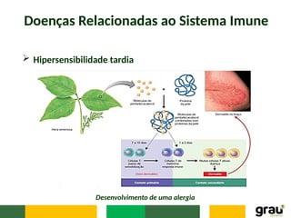 Doenças Relacionadas ao Sistema Imune
 Hipersensibilidade tardia
Desenvolvimento de uma alergia
 