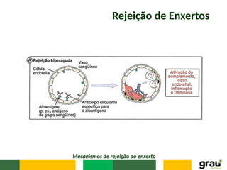 Rejeição de Enxertos
Mecanismos de rejeição ao enxerto
 
