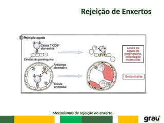 Rejeição de Enxertos
Mecanismos de rejeição ao enxerto
 